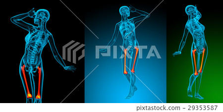 3d rendering medical illustration of femur bone 3d rendering medical illustration of femur bone 29353587