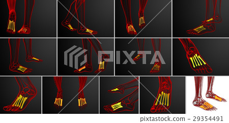 3d rendering medical of the metatarsal bones 29354491
