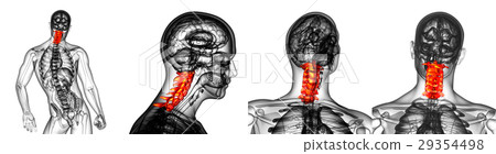 3d rendering medical  of the cervical spine 29354498