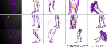3d rendering medical illustration of patella bone 3d rendering medical illustration of patella bone 29354936