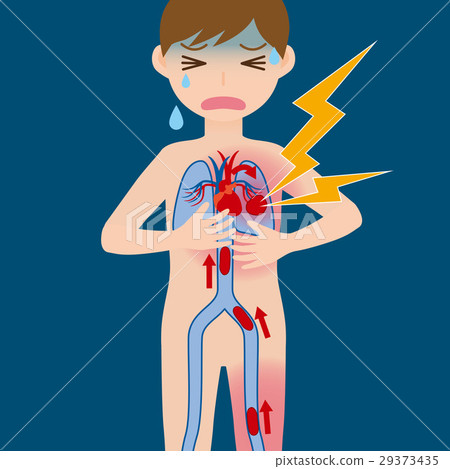 經濟艙綜合症 經濟艙綜合症 29373435