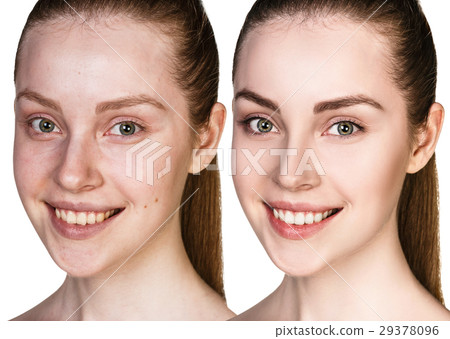 Young woman without and with makeup Young woman without and with makeup 29378096
