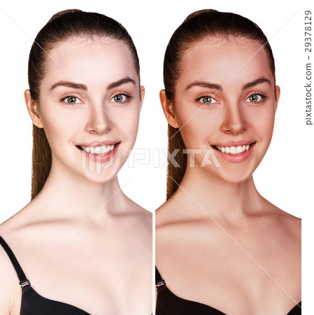 Young woman before and after tanning. Young woman before and after tanning. 29378129