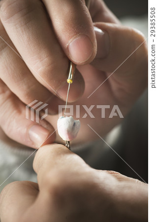 Dental Prosthesis Dental Prosthesis 29385508