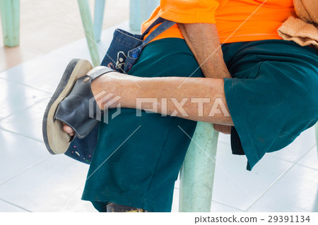 feet of old asian woman suffering from leprosy feet of old asian woman suffering from leprosy 29391134