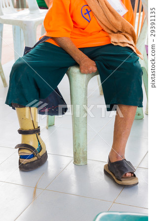 hand of old asian woman suffering from leprosy 29391135