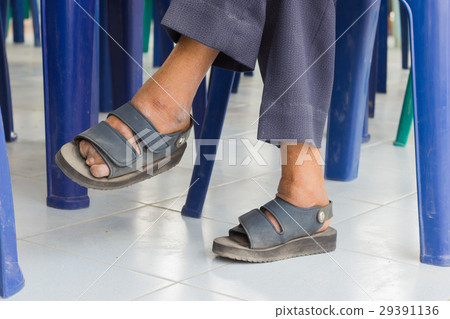 feet of old asian man suffering from leprosy 29391136