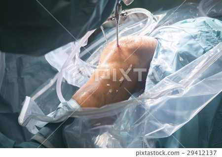 Knee surgery hospital operation Knee surgery hospital operation 29412137
