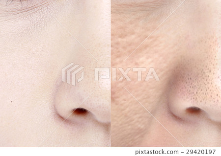 Nose skin surrounding beauty image 29420197