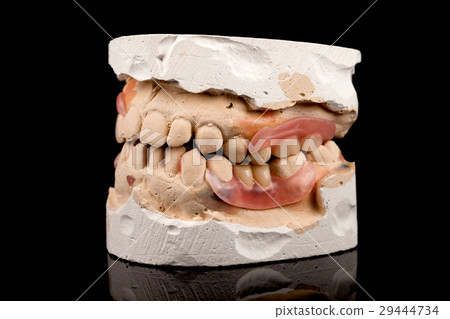 Dentures on a plaster cast 29444734
