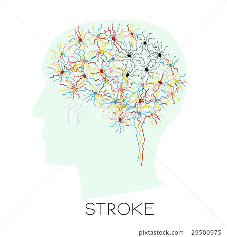 Stroke concept with human head silhouette 29500975