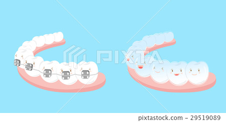 tooth wear different brace tooth wear different brace 29519089