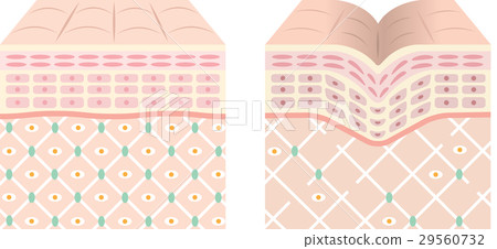 健康的皮膚皺紋皮膚 健康的皮膚皺紋皮膚 29560732