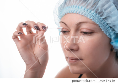 Blepharoplasty of the upper eyelid. Blepharoplasty of the upper eyelid. 29617516