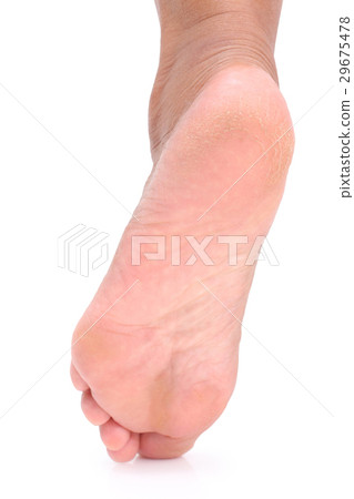 Cracks on Heels. Cracks on Heels. 29675478