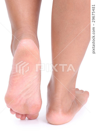 Cracks on Heels. Cracks on Heels. 29675481