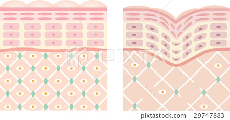 健康的皮膚皺紋皮膚橫截面 29747883