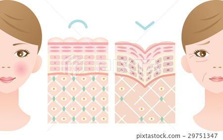 Young skin wrinkle skin cross section 29751347