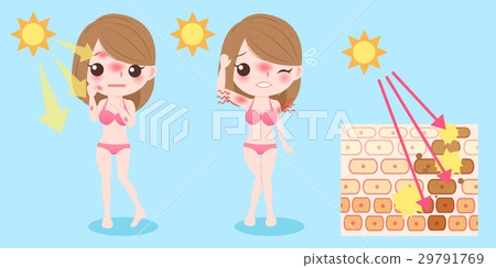 woman with sunburn problem woman with sunburn problem 29791769