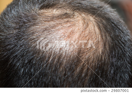 Light hair 29807001