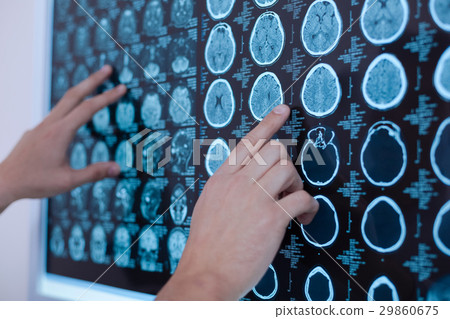 X ray images of human brain being put on the X ray images of human brain being put on the 29860675