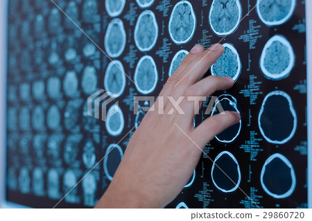 Doctors hand pointing at the brain photo Doctors hand pointing at the brain photo 29860720