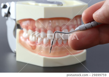 牙周病篩查（探針） 29899759