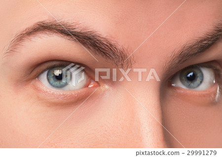 Beautiful blue man eyes close up Beautiful blue man eyes close up 29991279