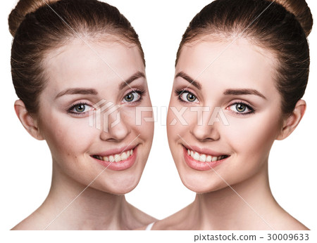 Young woman before and after retouch. 30009633