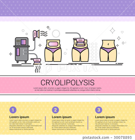 Cryolipolysis Cosmetology Infographics Salon 30078893