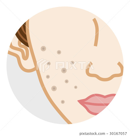 Cheek pore 30167057