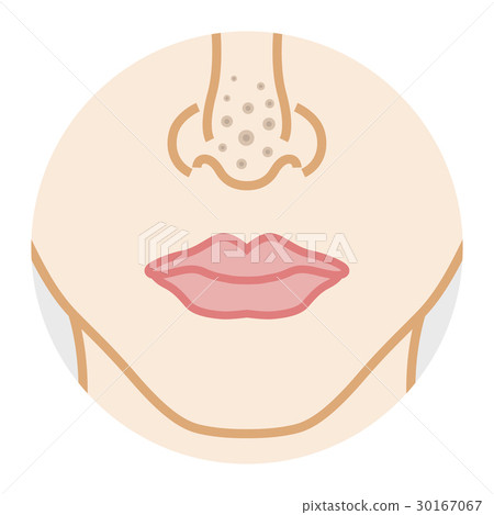 Nose pore darkening - Body parts Nose pore darkening - Body parts 30167067