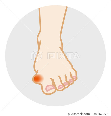Halluxu halibody身體部位正面 30167072