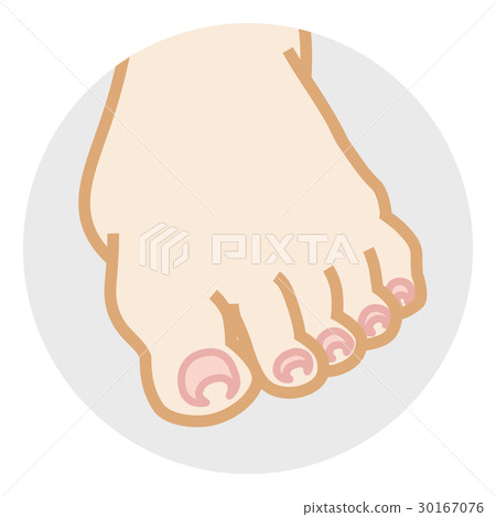 Spiral nail body parts Spiral nail body parts 30167076