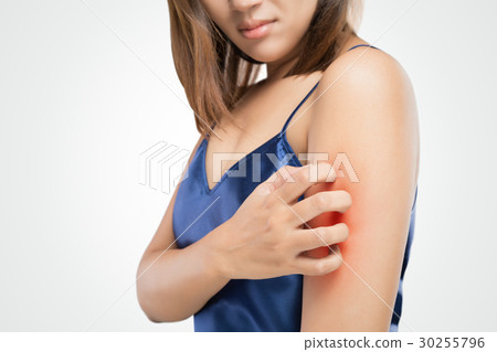 People scratch the itch with hand, Upper arm, itching, Healthcar People scratch the itch with hand, Upper arm, itching, Healthcar 30255796