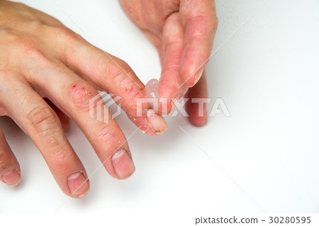 topical cream topical cream 30280595