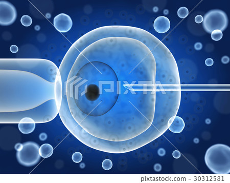 Artificial ovum fertilization 30312581