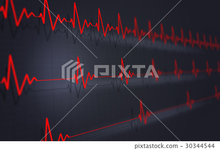 Heart Pulse Illustration 30344544