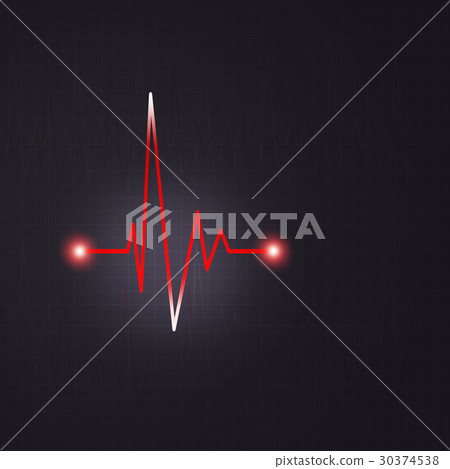 Heart Rhythm Illustration 30374538