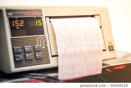 Close up of monitor print out in delivery room 30408526