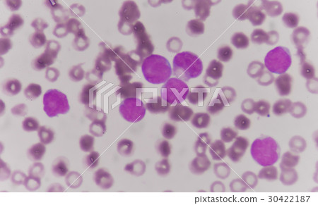 blood smear is often used as a follow-up test 30422187
