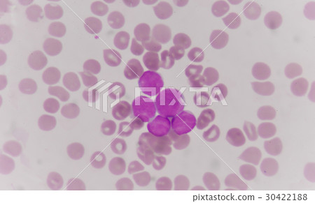 blood smear is often used as a follow-up test 30422188