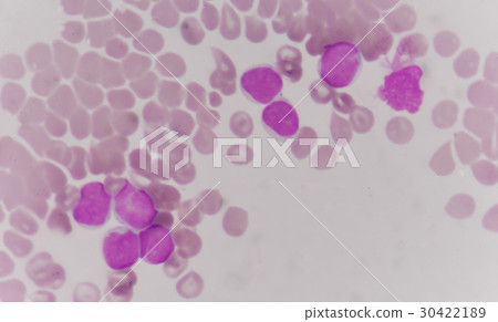 blood smear is often used as a follow-up test 30422189