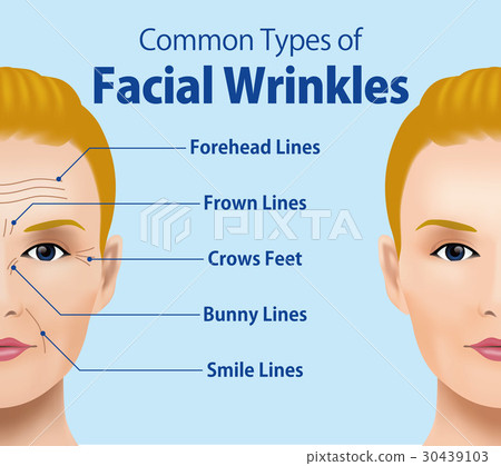 Types of facial wrinkles 30439103