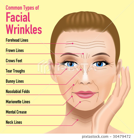 Types of facial wrinkles - Stock Illustration [30479472] - PIXTA