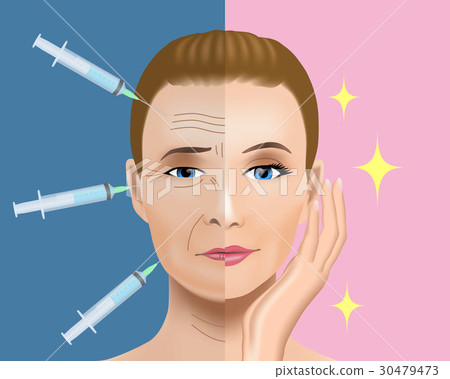 整容手術圖像 30479473
