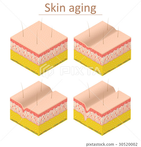 Skin Aging Set Isometric View. Vector 30520002