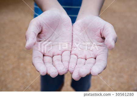 Boy open withered skin hands Boy open withered skin hands 30561280