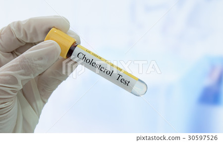 cholesterol test cholesterol test 30597526