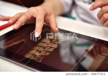 Doctor Using Tablet With X-ray 30677351